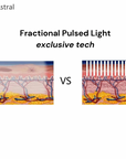 Astral F10 All-in-One Pulsed Light System- IPL + SHR + DPL + NIR + FPL