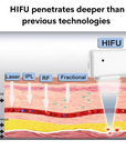 9D Face Lifting HIFU Machine