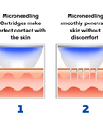 microneedling penetrates skin treatment 