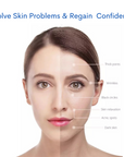 Beautiful Skin Side of Face versus Problem Skin Side of Face, Solve Skin Problems and Regain Confidence