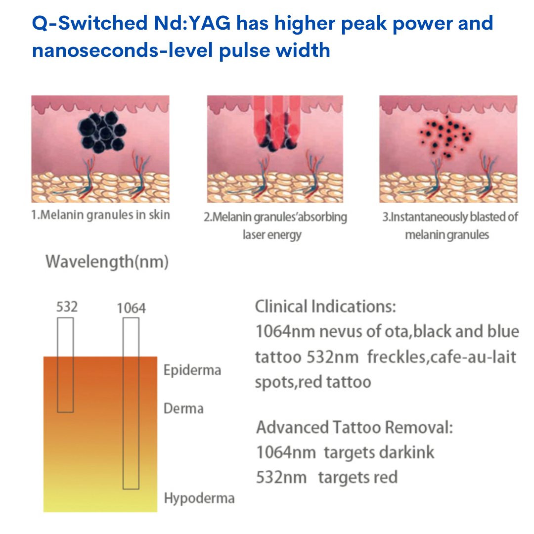 How a switched nd:YAG has super pulse and pulse 