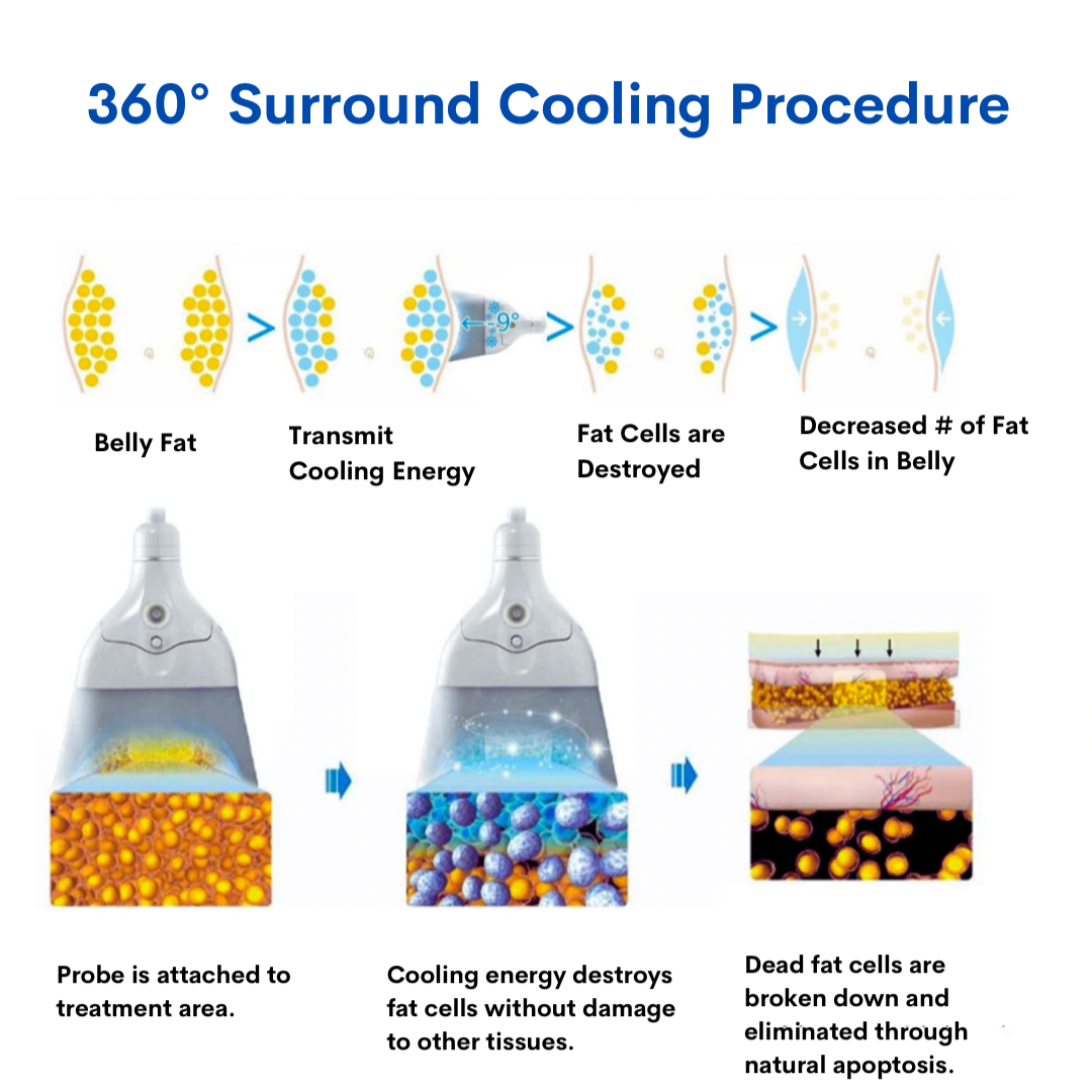 Freezing Attachments for 360 Degrees Cryo Machine